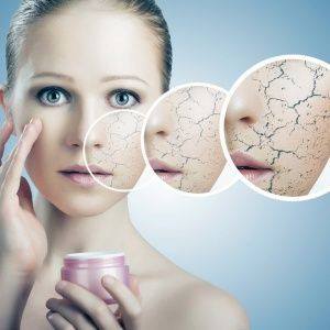 Суха шкіра - Які симптоми сухої шкіри на обличчі?
