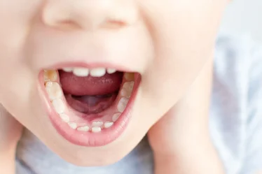 Рекомендации стоматологов: как ухаживать за зубами у детей