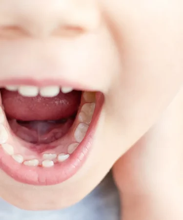 Рекомендации стоматологов: как ухаживать за зубами у детей