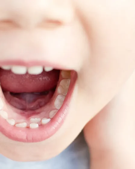 Рекомендации стоматологов: как ухаживать за зубами у детей