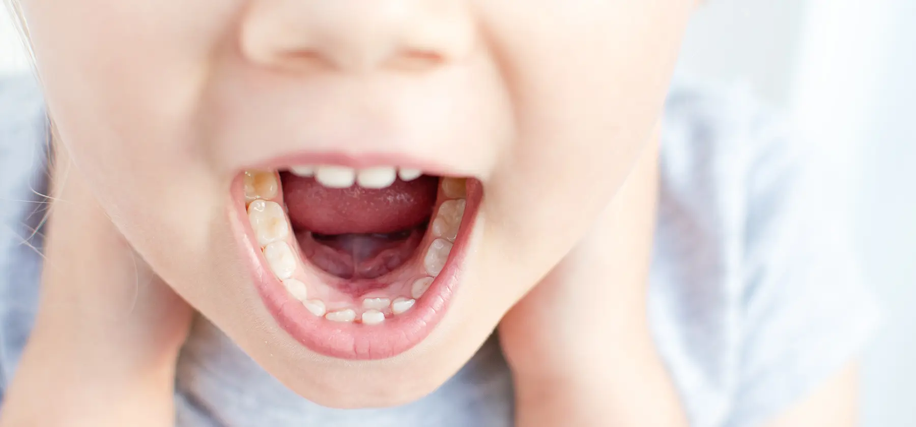 Рекомендации стоматологов: как ухаживать за зубами у детей